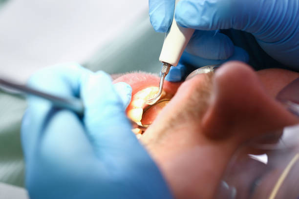 Best Weekend Emergency Dentist in Sunbury, OH